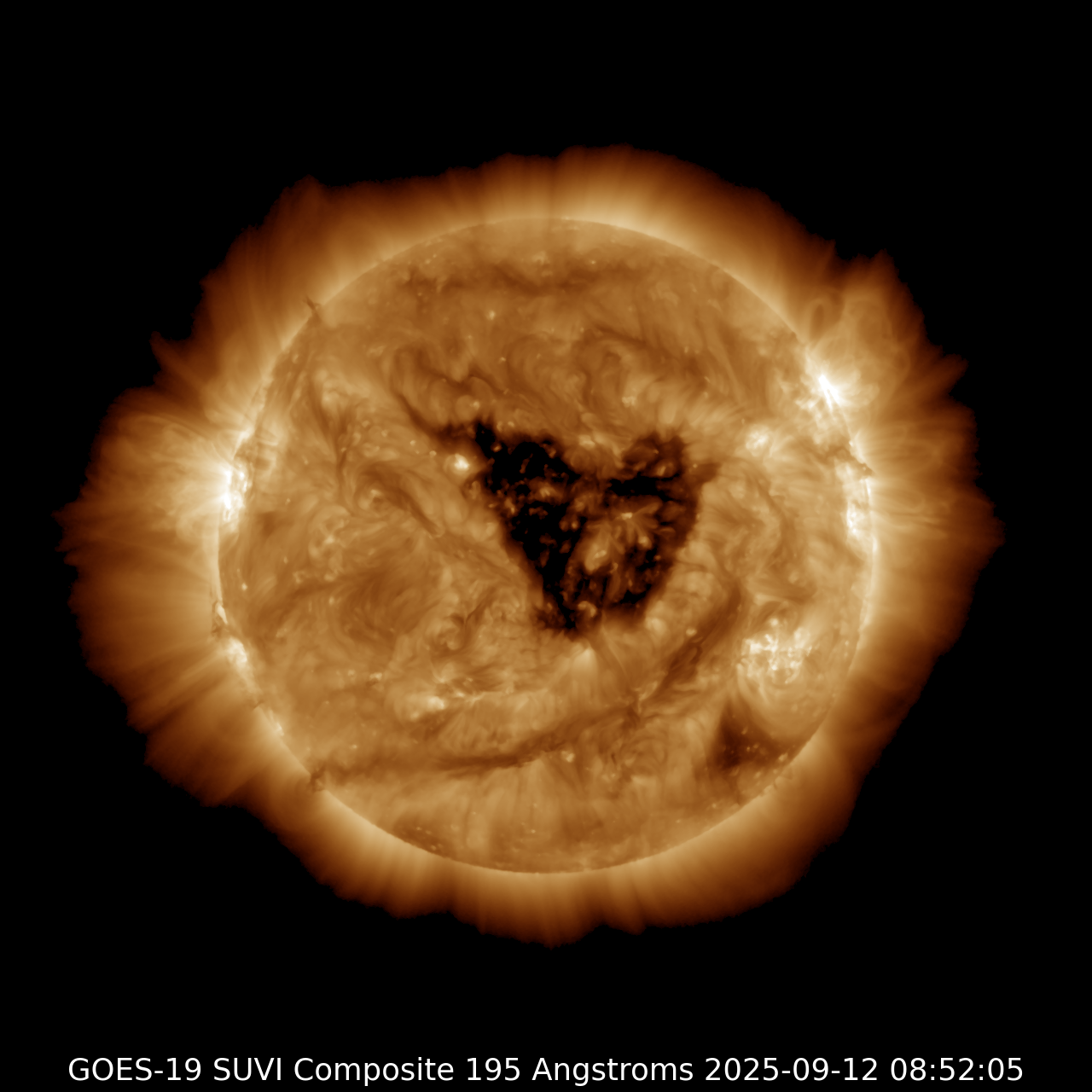 Large cornoal hole on September 14, 2025.